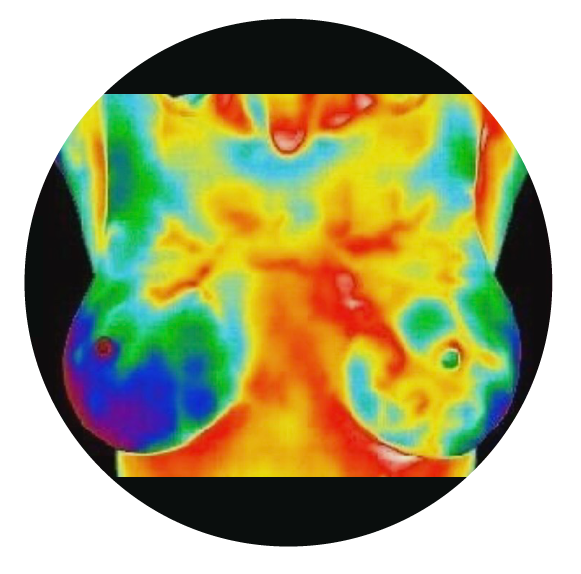 5.3-IMAGE-Thermography